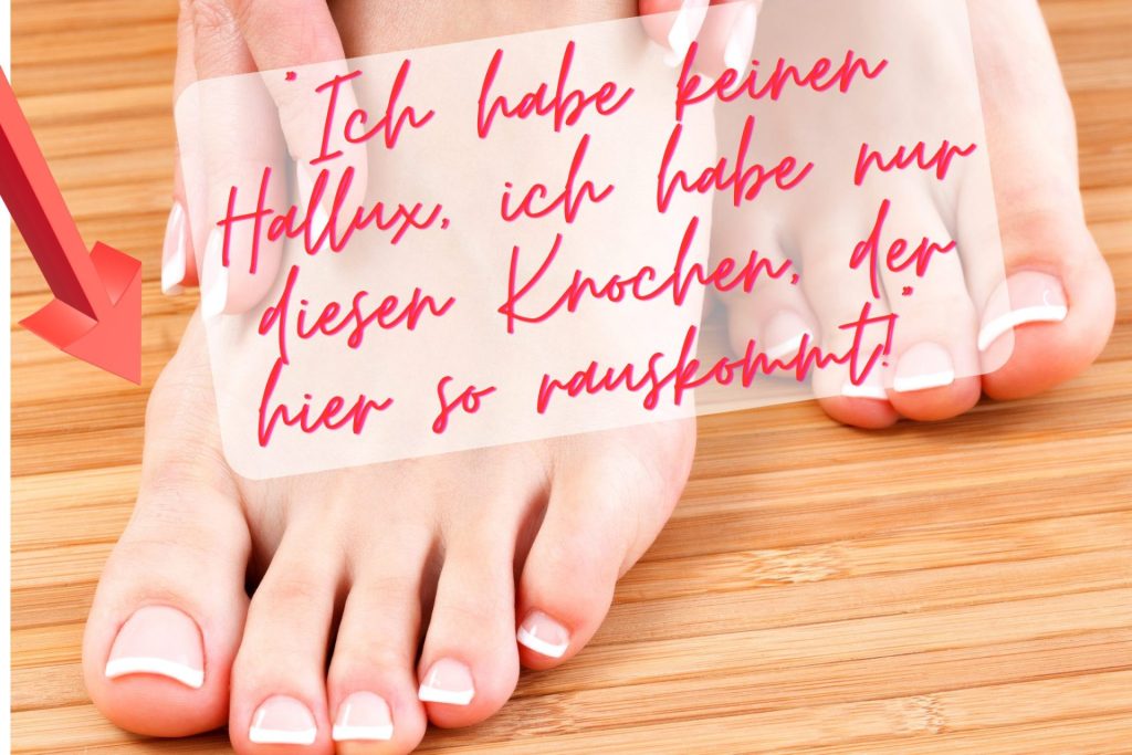 Hallux valgus Ballenzeh